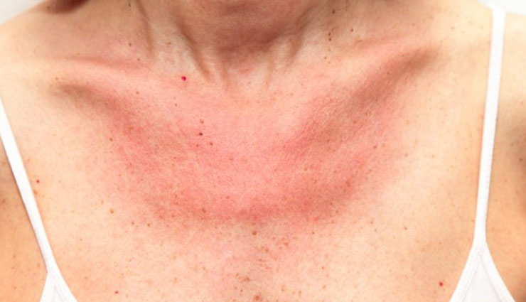 Skin Ellergy 1536046448 Lb Satya Day