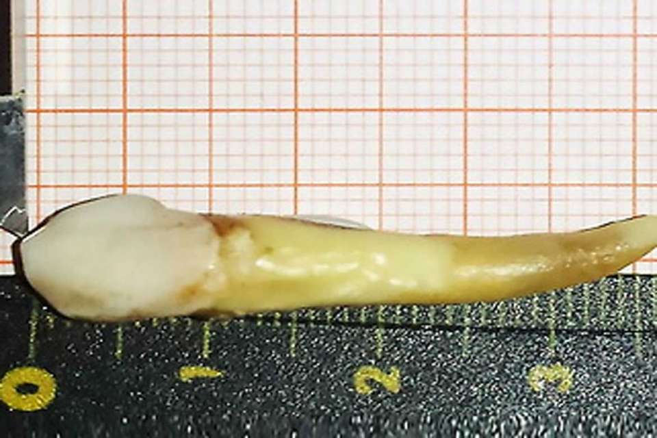 longest tooth 2