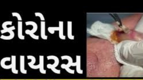 ચાઇના એ પ્રતિબંધિત ‘કોરોના બૉમ્બ’ લીકેજ કરી દુનિયા માં માનવ સંહાર કર્યો છે, અમેરિકન કંપનીએ દાવો માંડ્યો ! WhatsApp Image 2020 03 26 at 7.33.00 PM