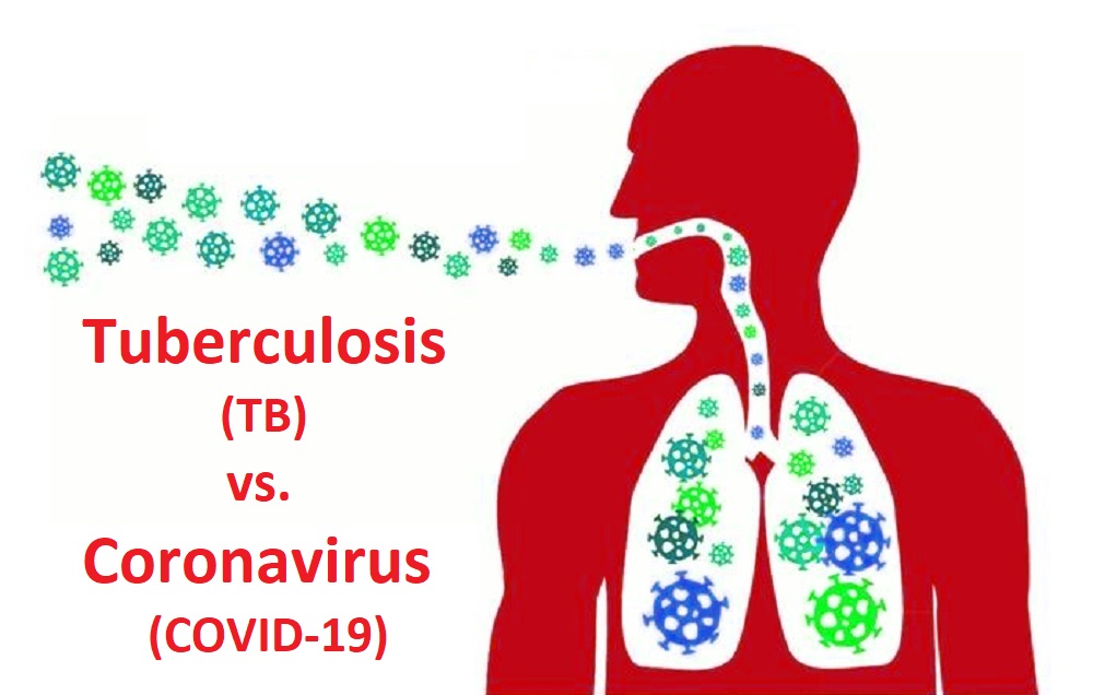 Tuberculosi TB