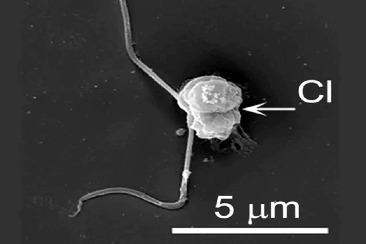Picozoa 1 Satya Day