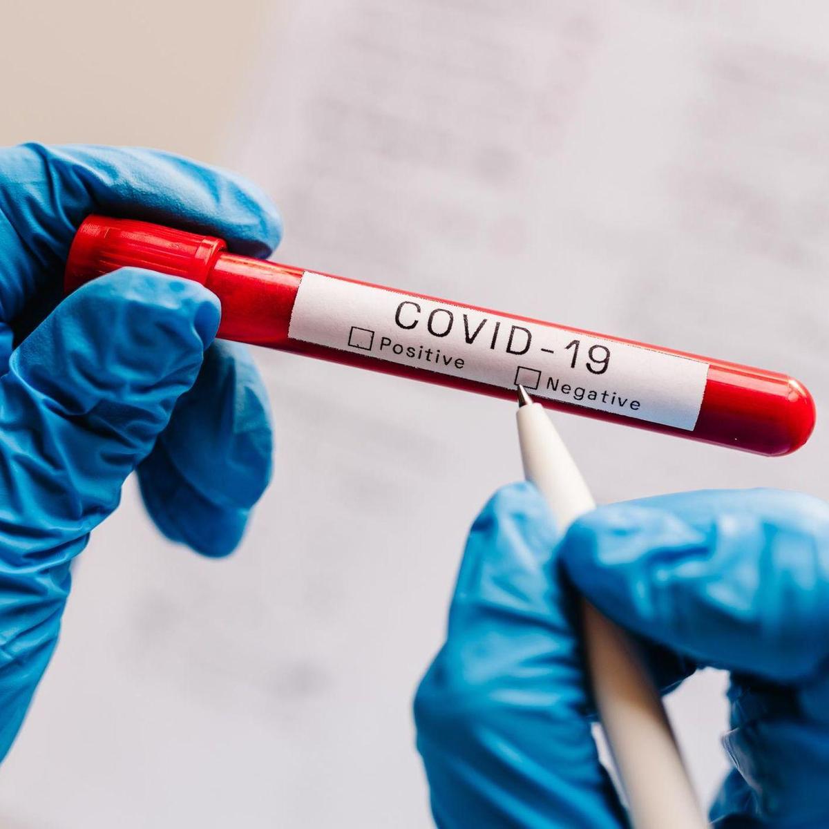 coronavirus negative report