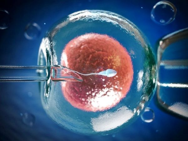 Ivf