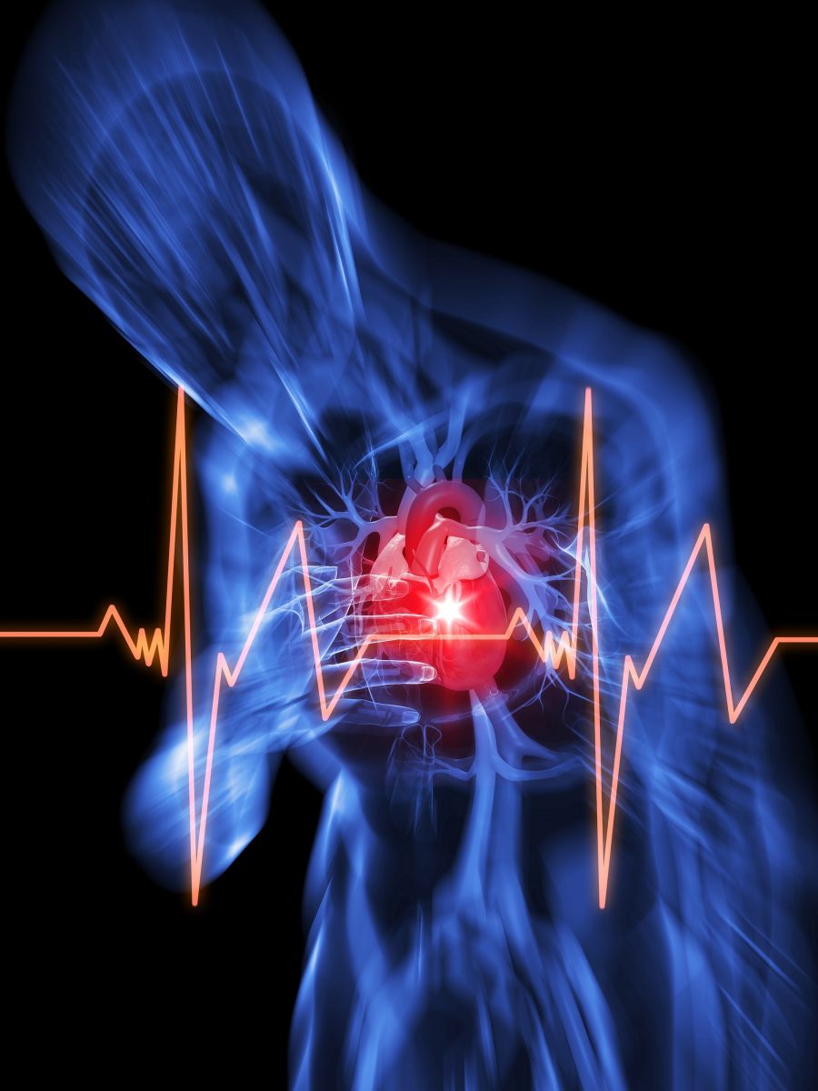 Cardiac Arrest