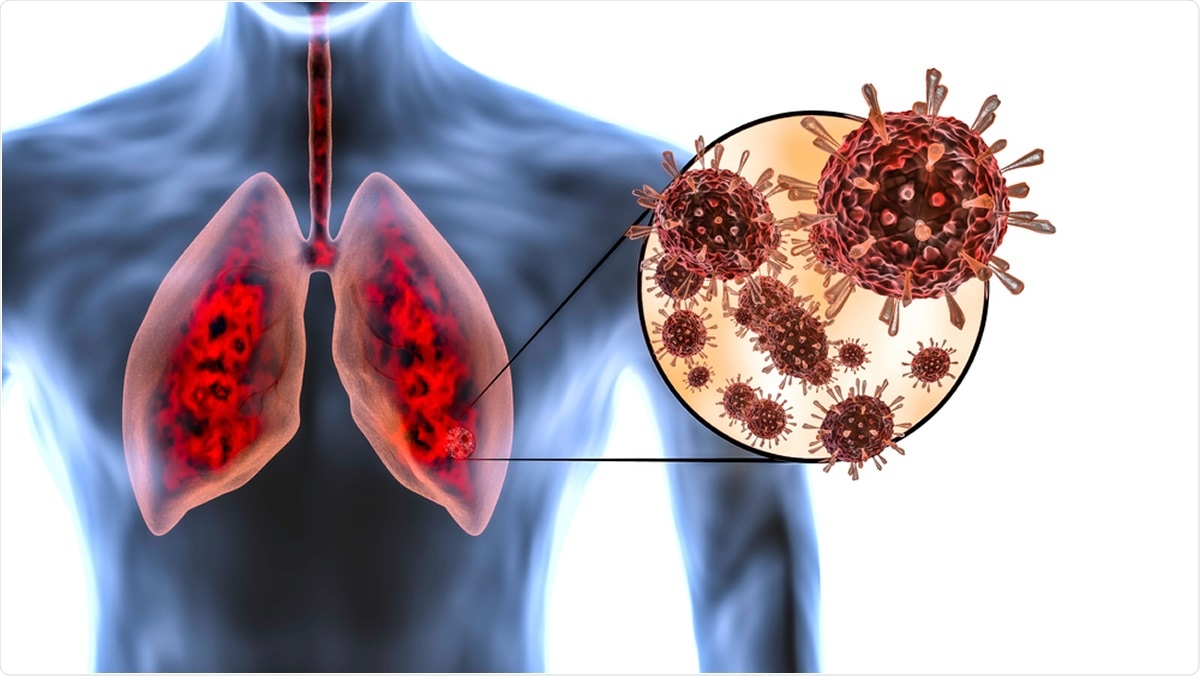 HEALTH: કોરોનાના કારણે વધી શકે છે શ્વાસ અને છાતીમાં દુખાવાની સમસ્યા ! Satya Day
