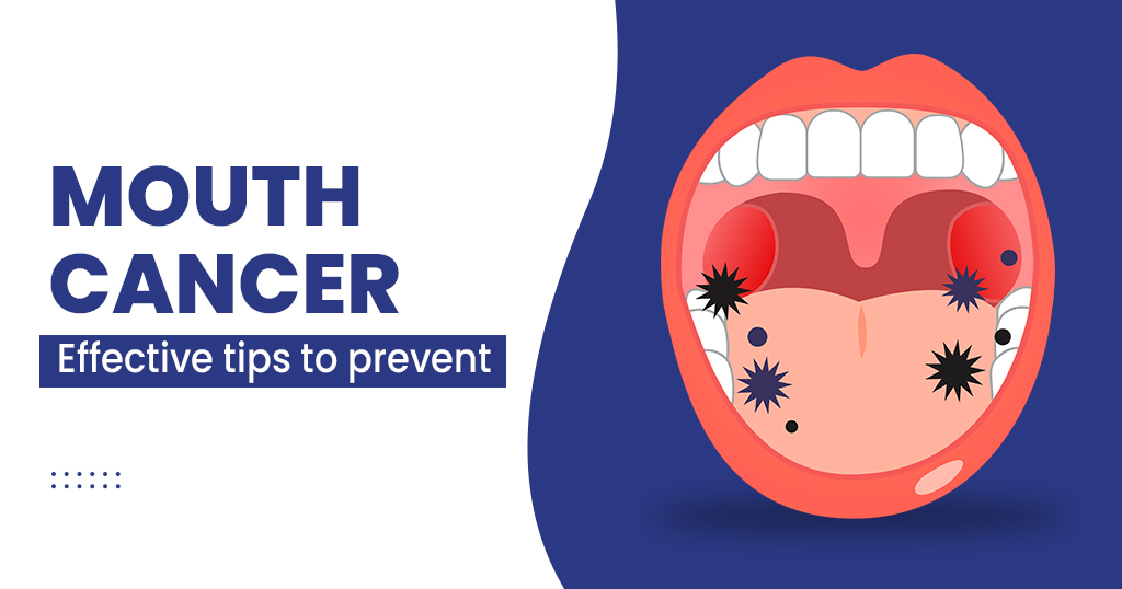 Mouth Cancer
