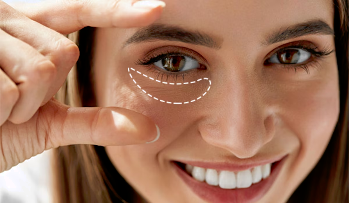 Dark Circles
