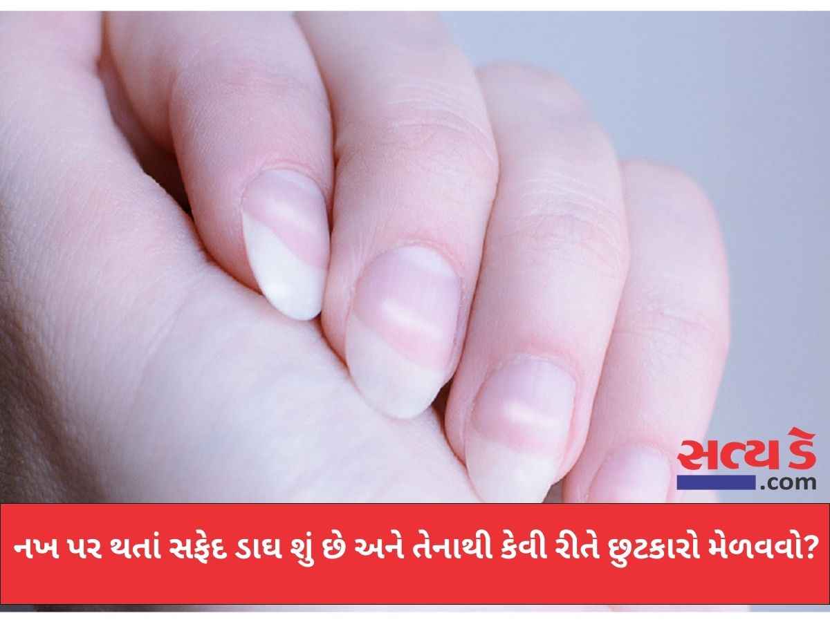 nail