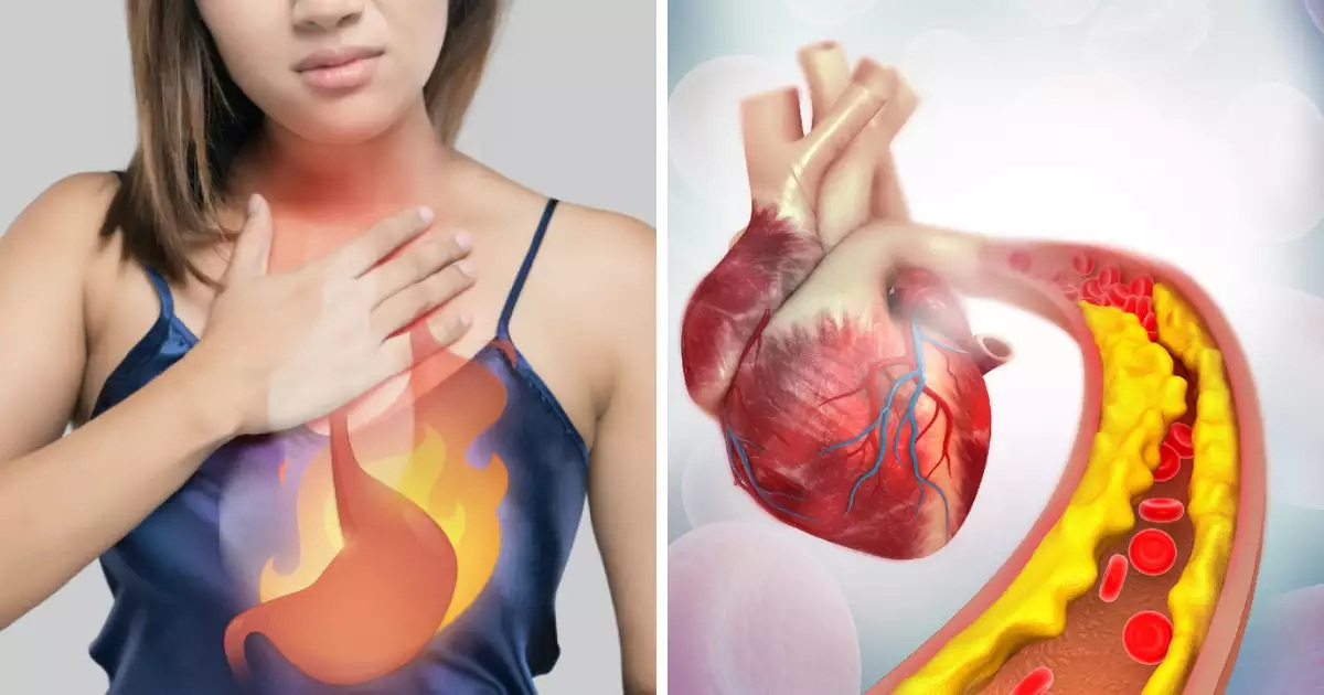 Heart_attack symptoms