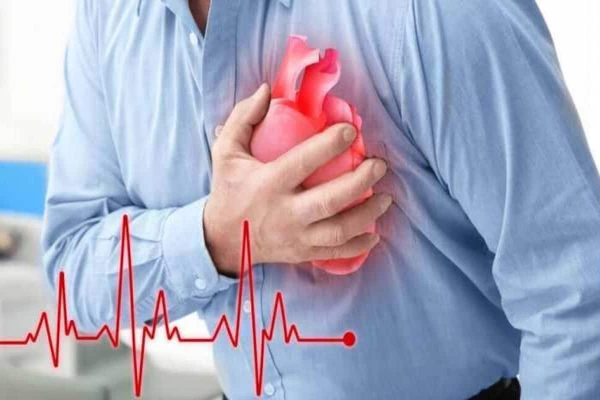 Cardiac Arrest