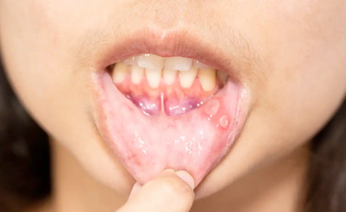 mouth