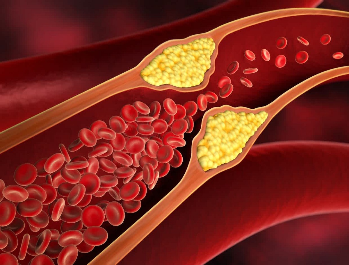 Cholesterol
