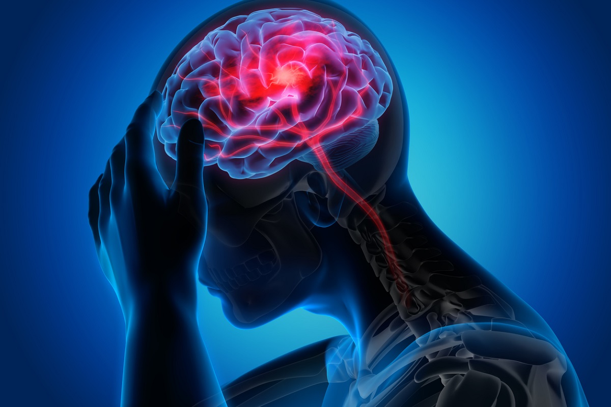 STROKE.1