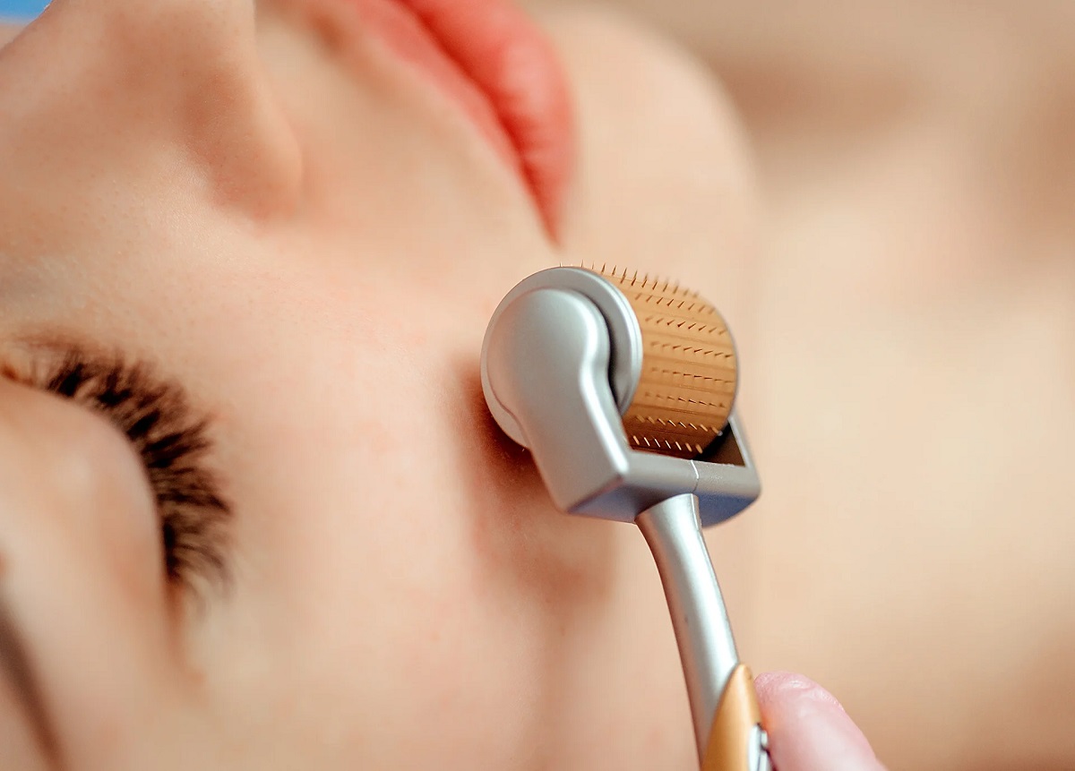 derma roller.1