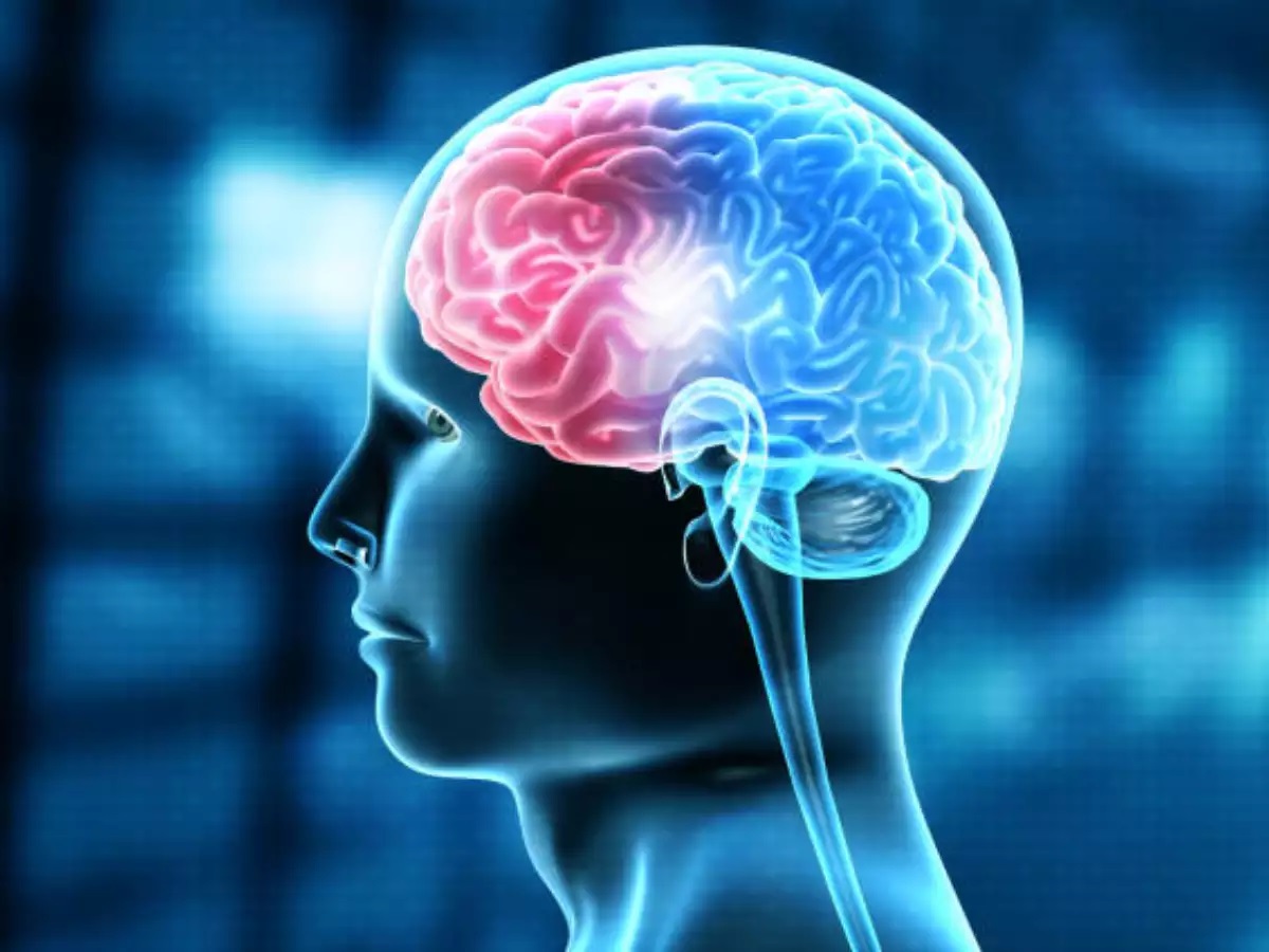 brain stroke