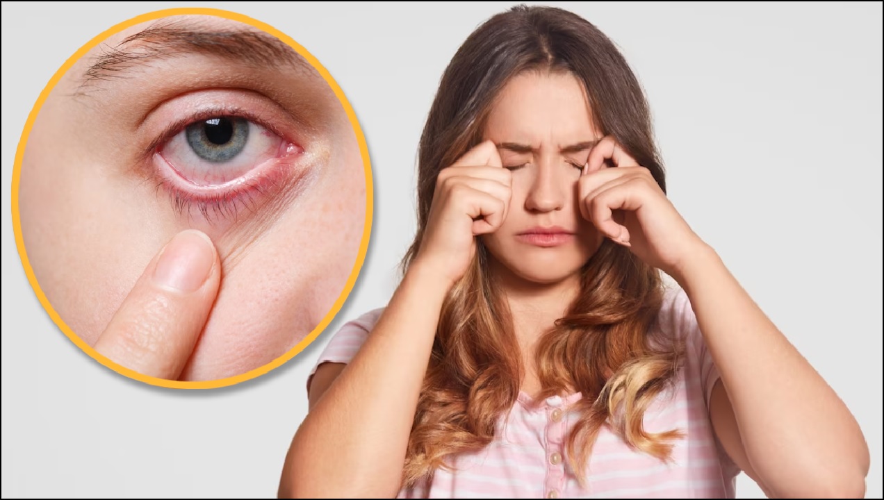 Vitamin B12 eye problem