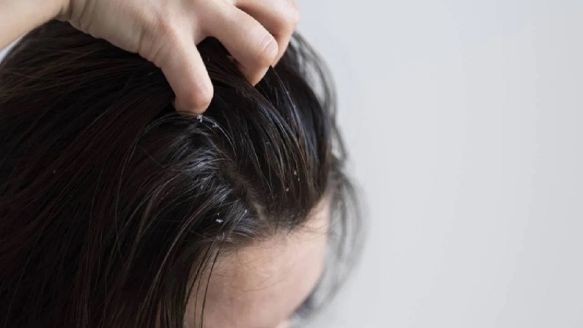 oily hair