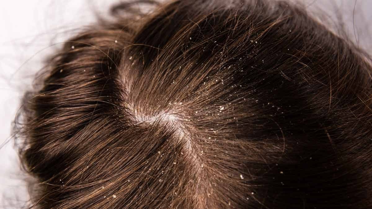 Hair Care tips