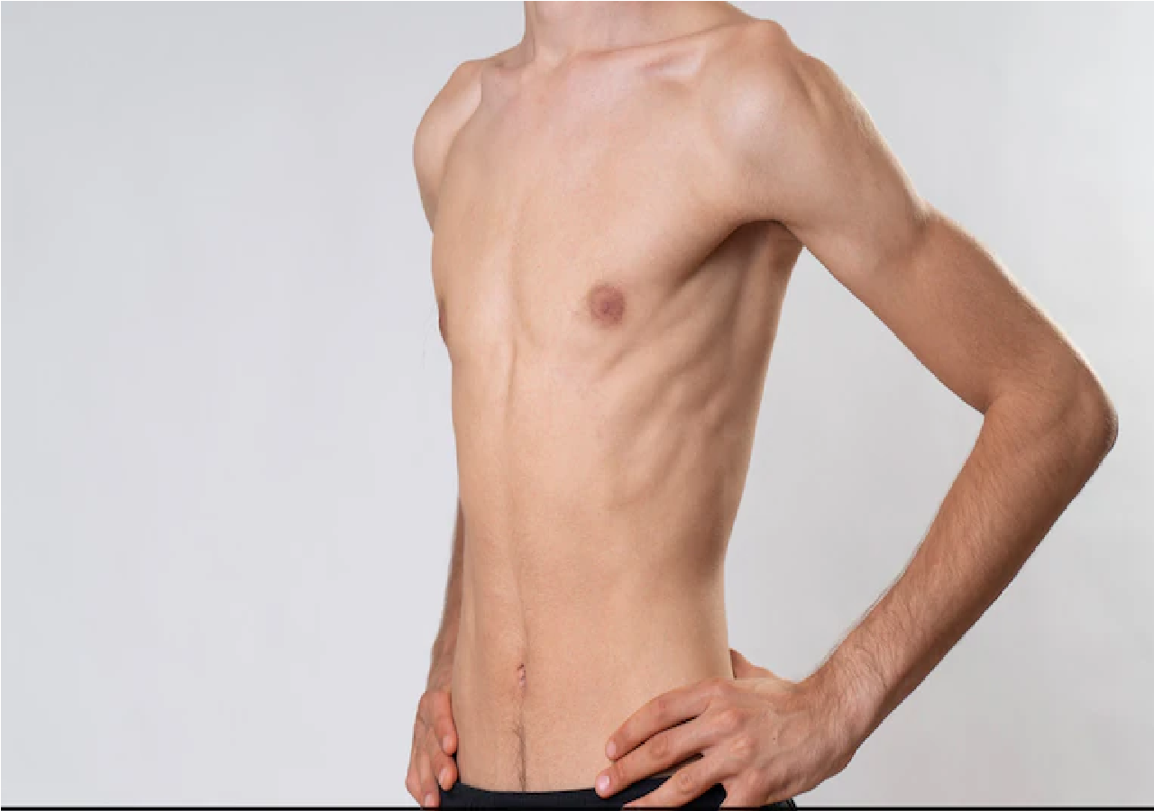 Weight Gain Tips