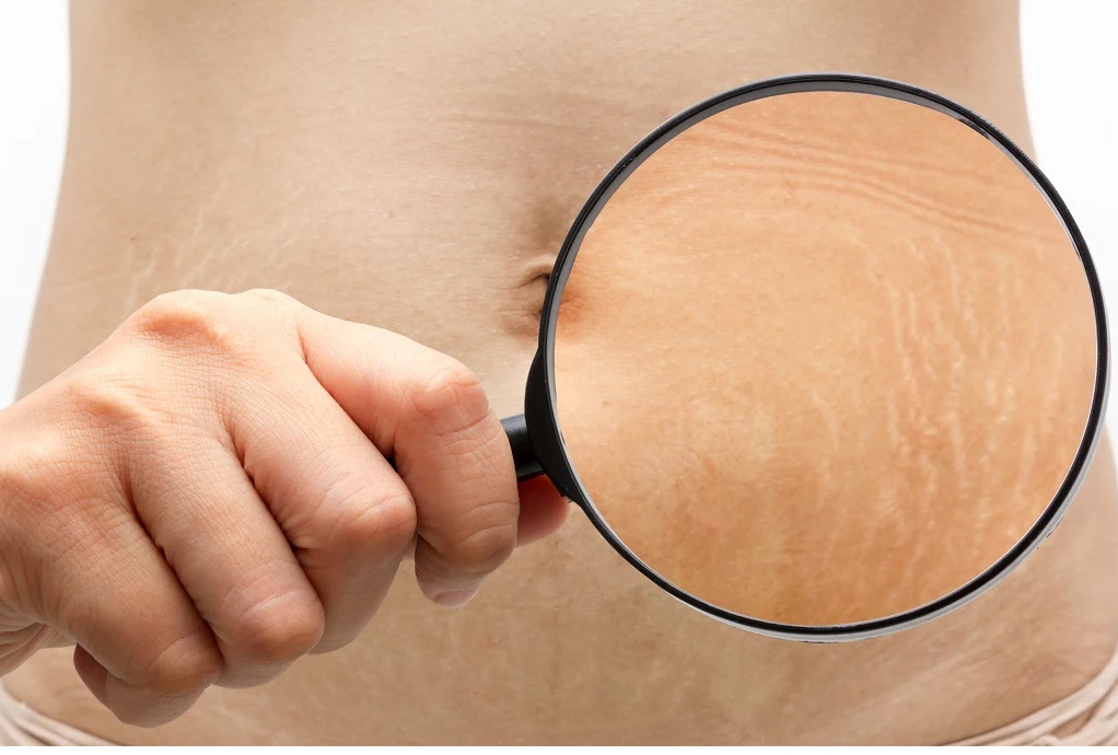 skin 2