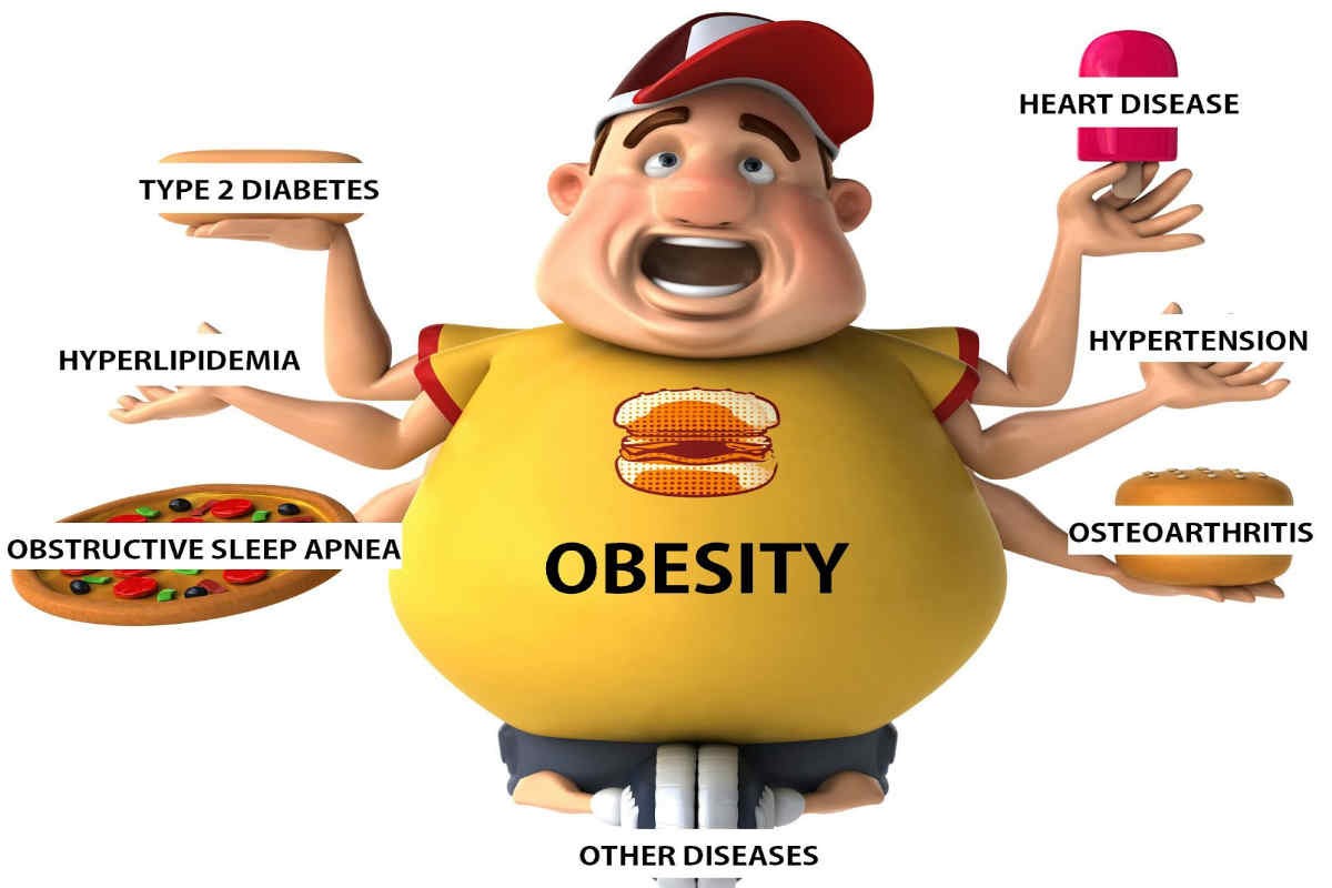 CHILD OBESITY.2