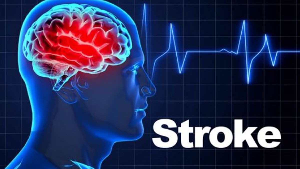 STROKE