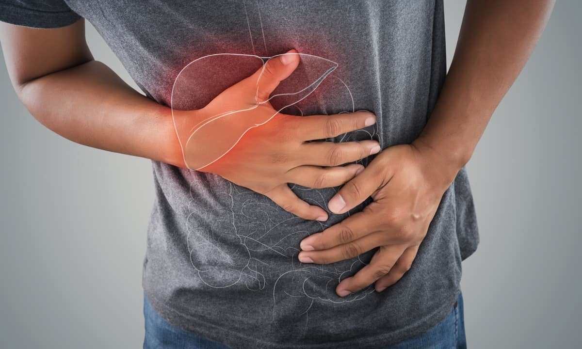 Fatty Liver causes