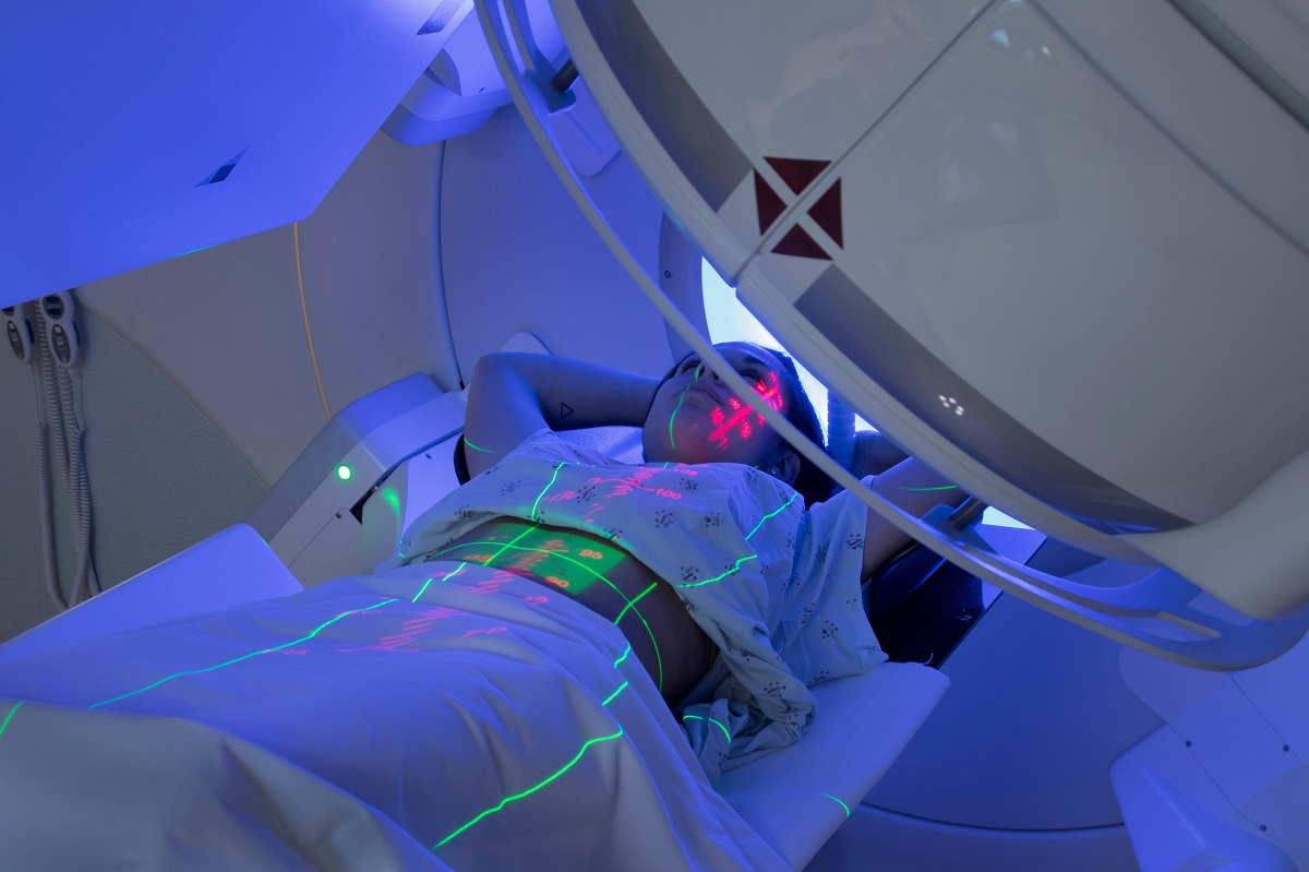 Radiotherapy
