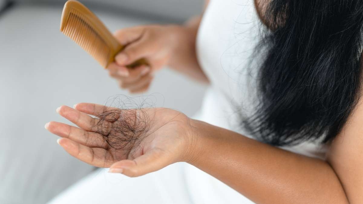Hair Loss