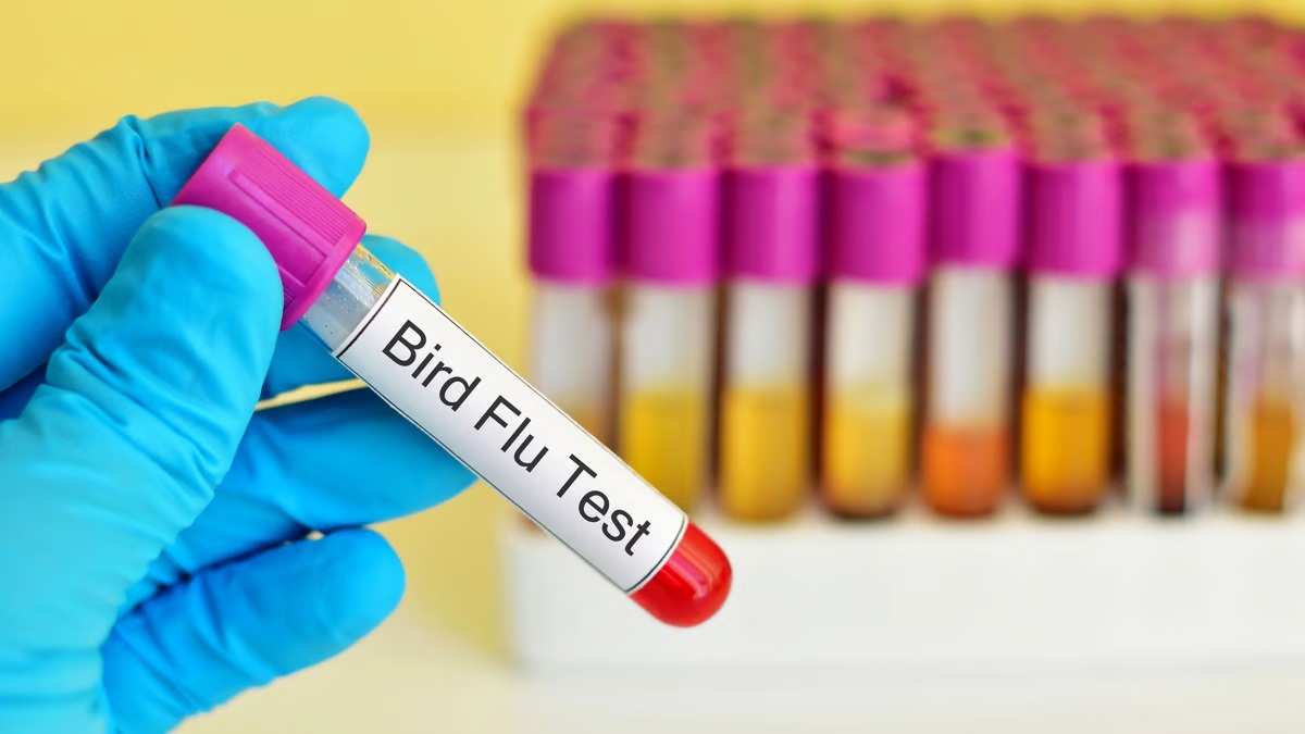Bird Flu