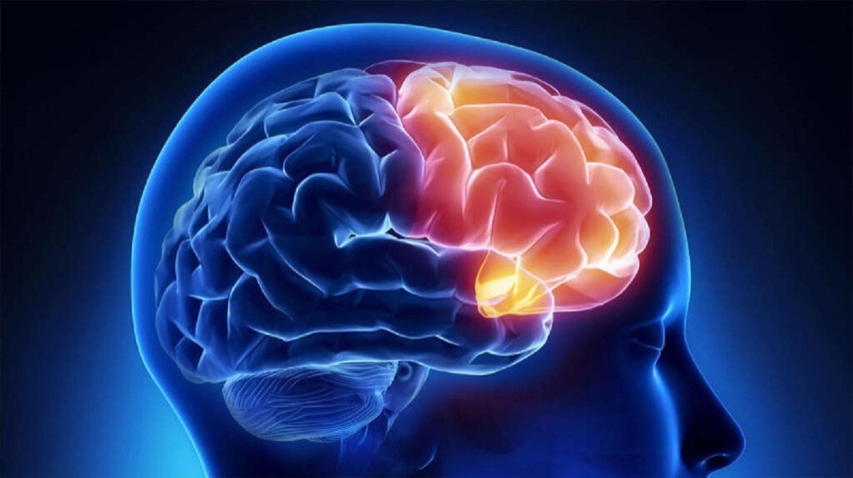Brain Disease