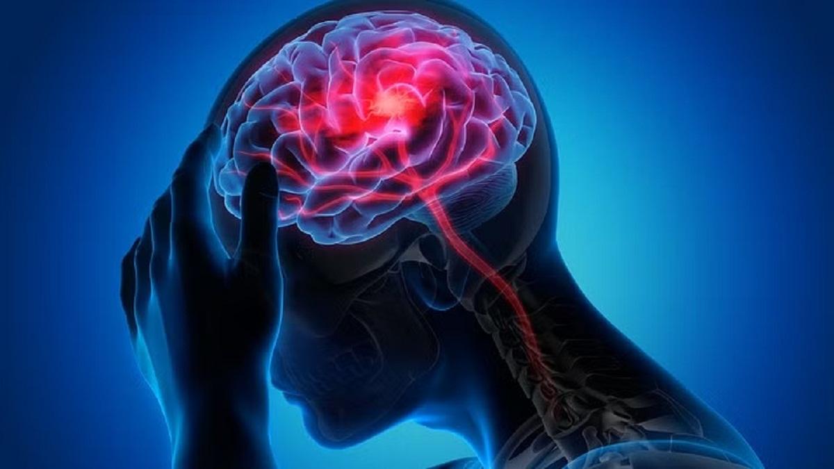 Stroke Risk Satya Day