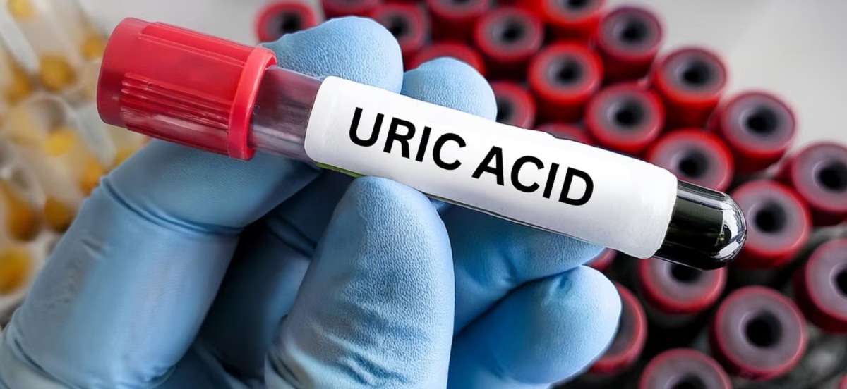 Uric Acid