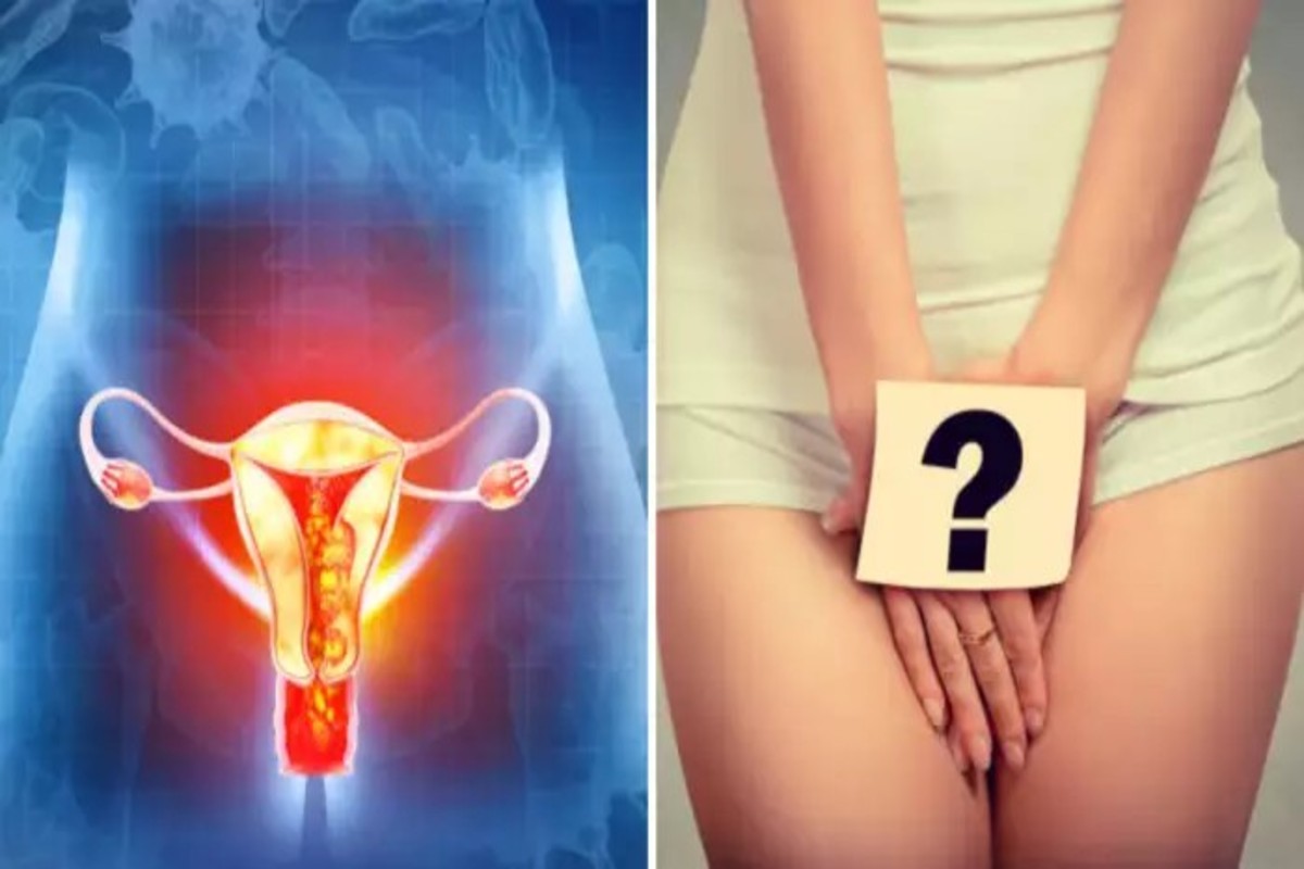Vaginal Dryness After 40