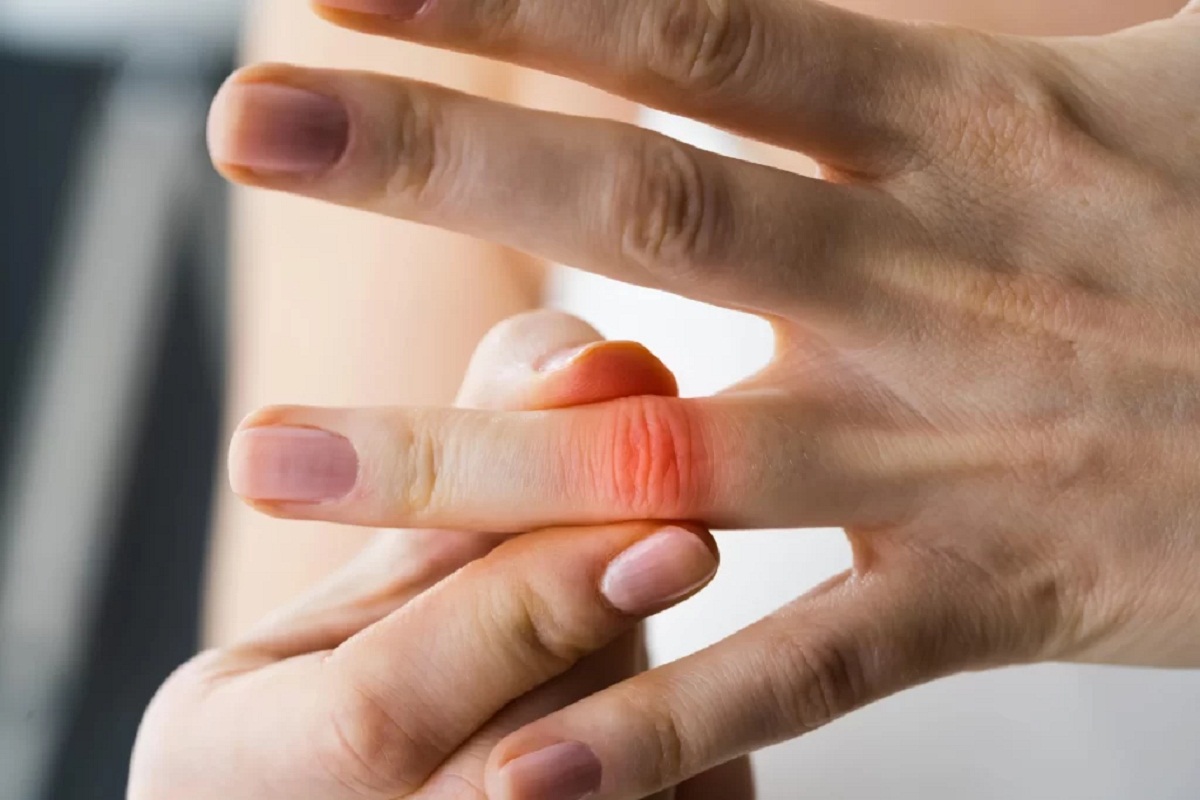 Fingers Pain