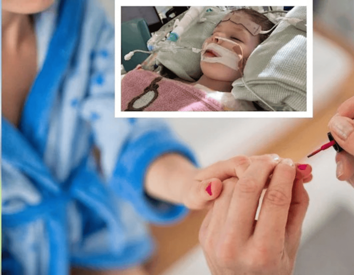 Girl in coma after nail paint