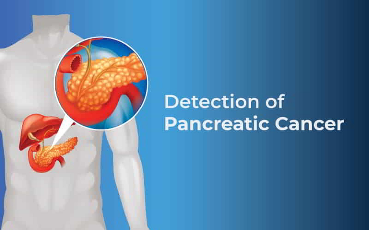 Pancreatic Cancer