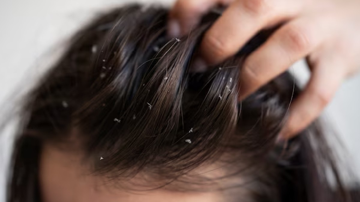 Hair Care