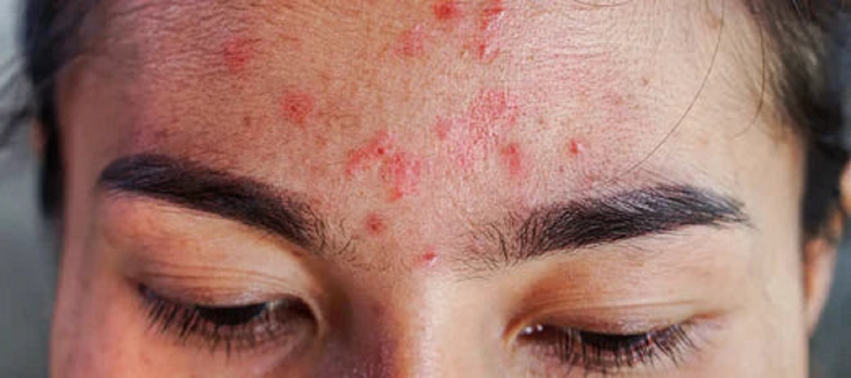 Skin Care