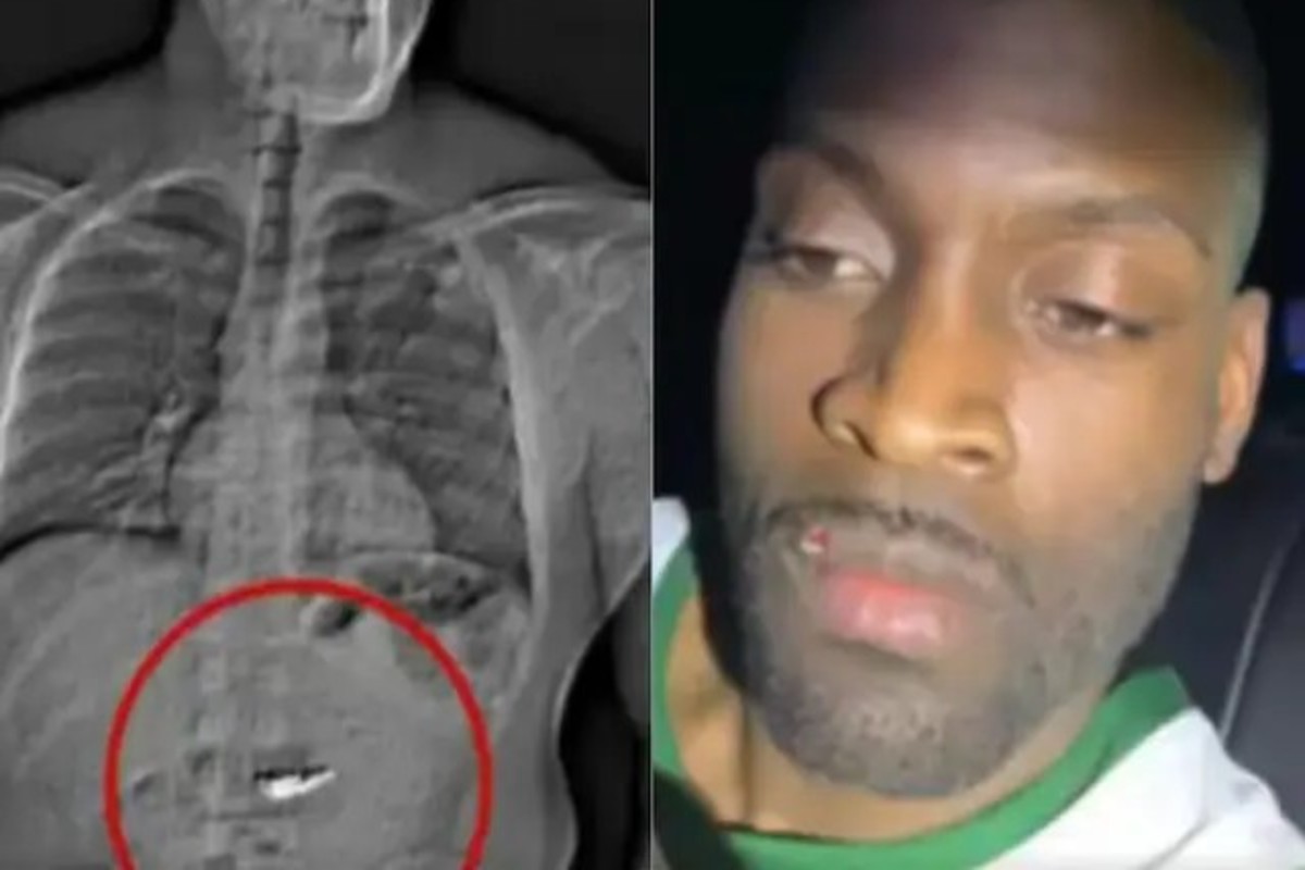 Man Swallow Diamond Worth 6 Crore Rupees