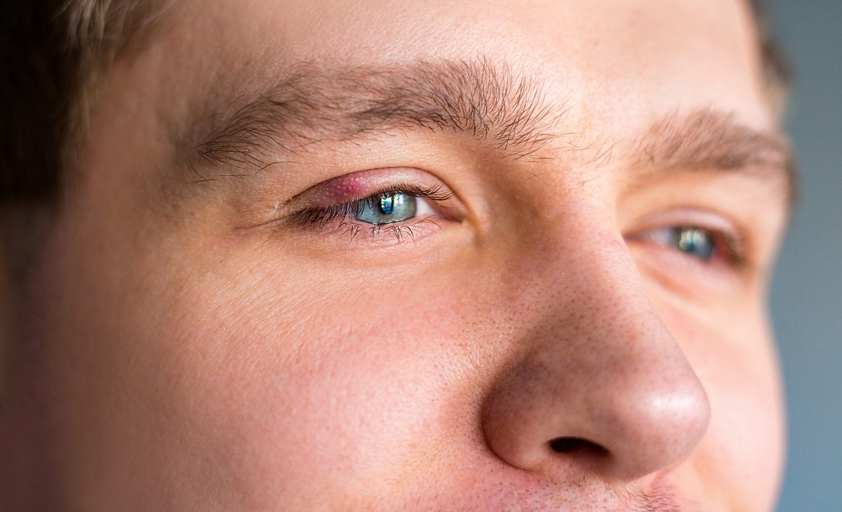 Sticky Eyes
