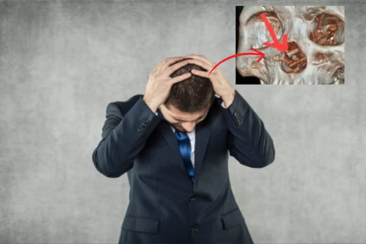 Chopsticks Found In Mans Brain
