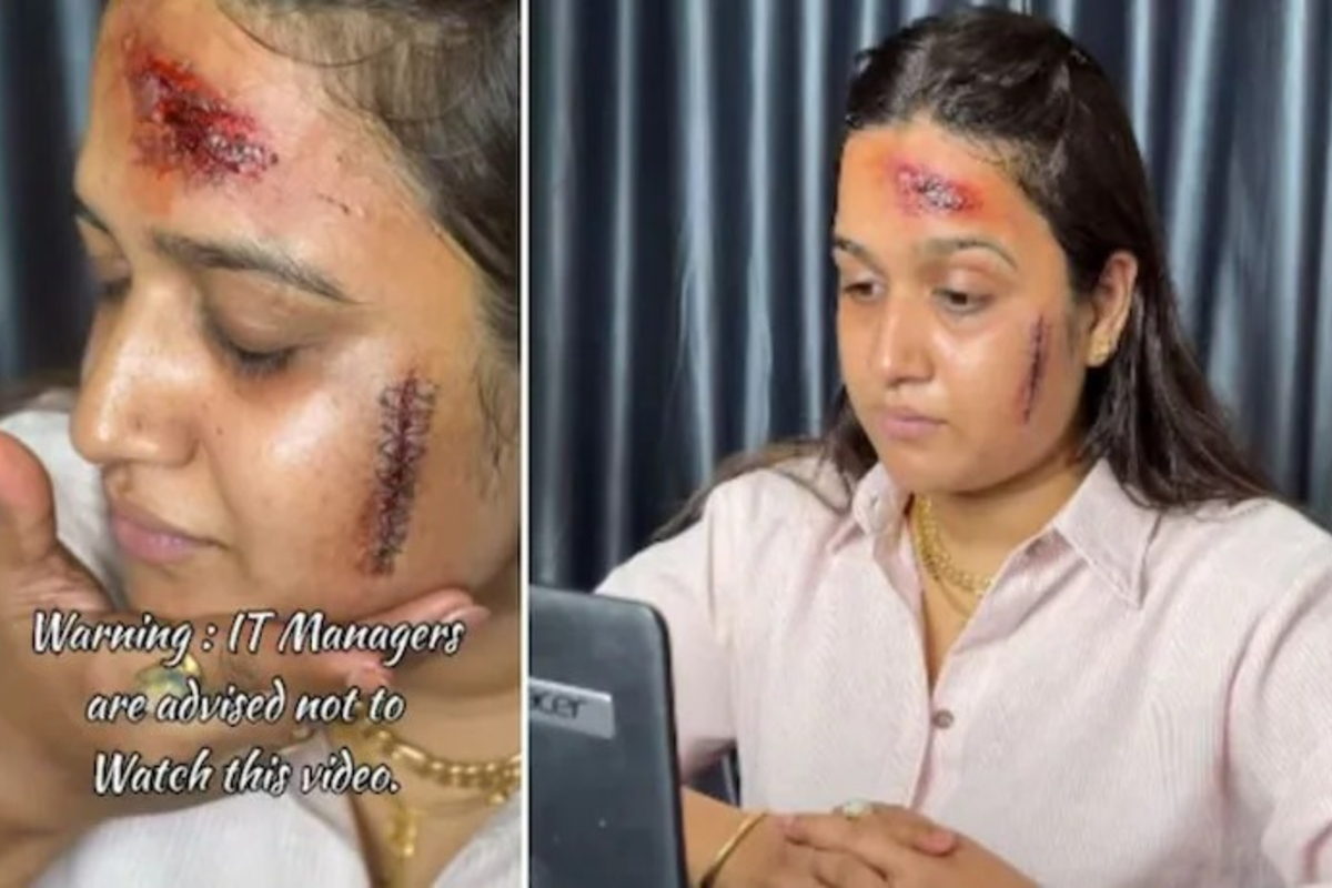 Fake Scars For Sick Leave Viral Video