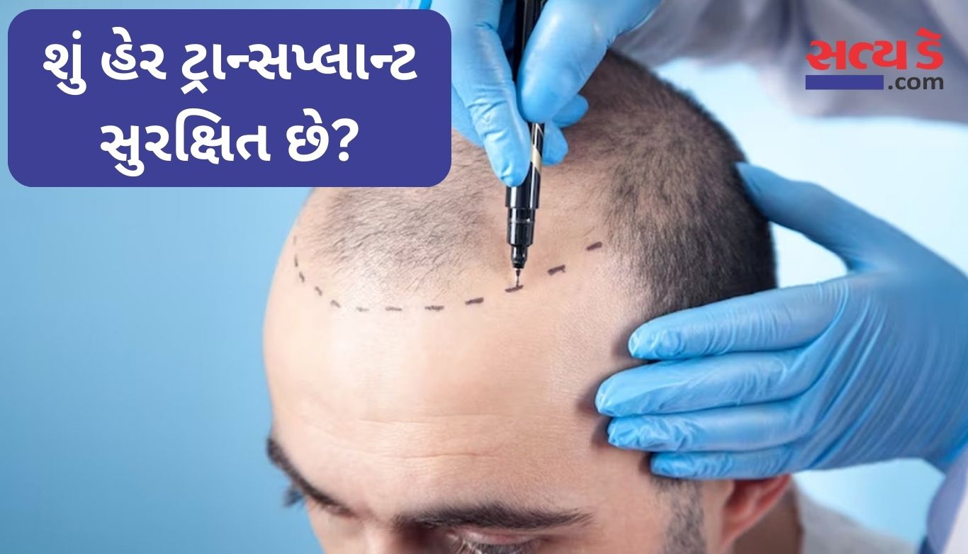Hair Transplant