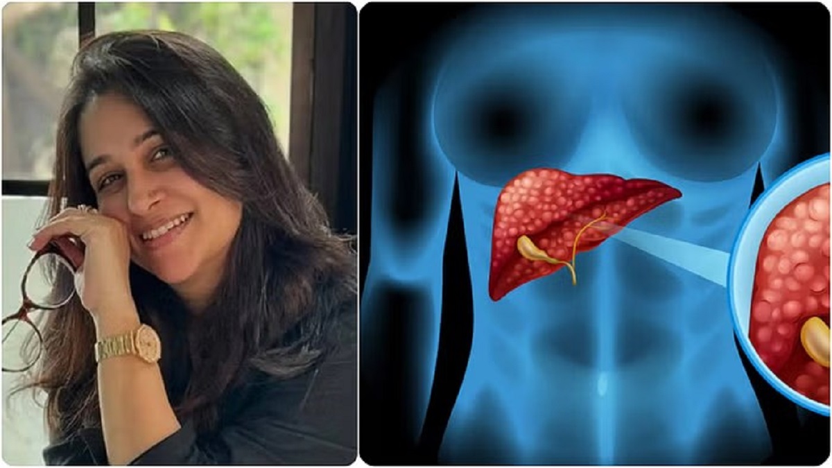 Liver Tumor