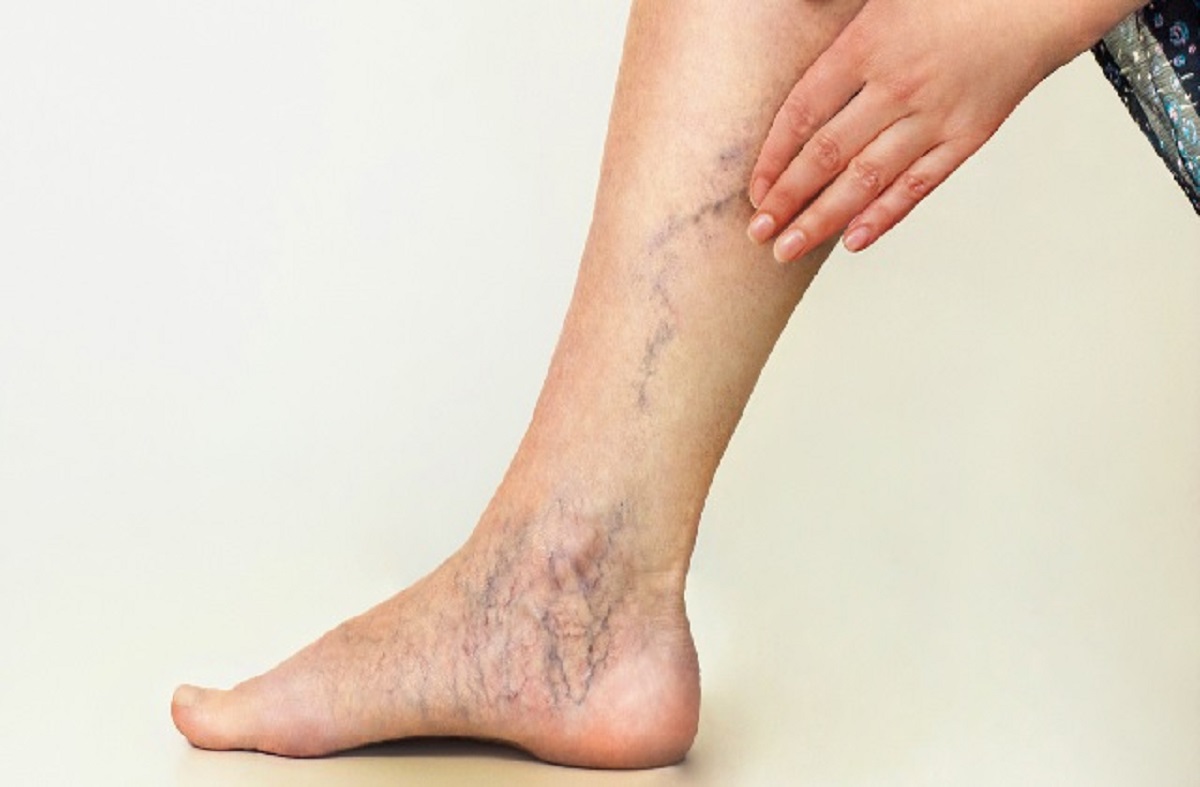 Why Do Veins Look Blue Or Green