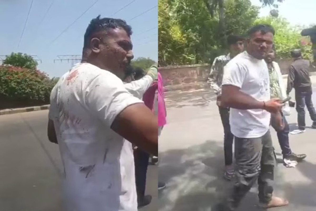 Ahmedabad Plane Crash Survivor