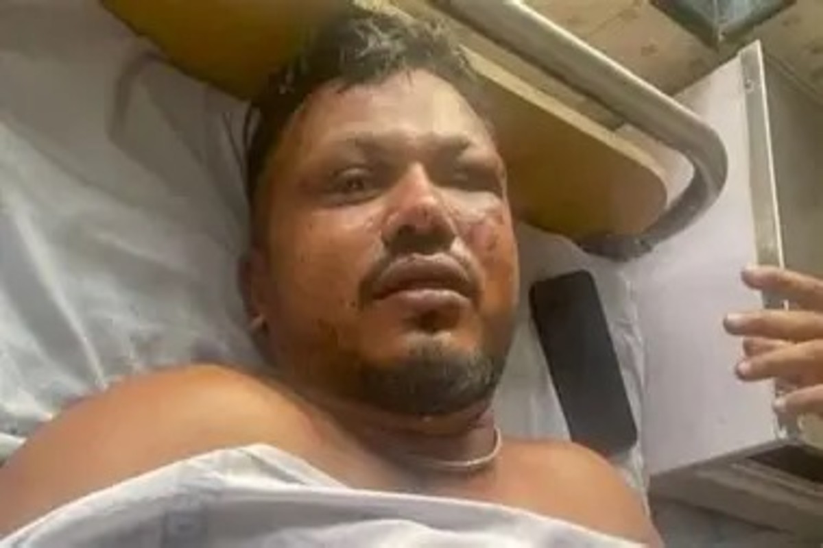 Ahmedabad Plane Crash Survivor
