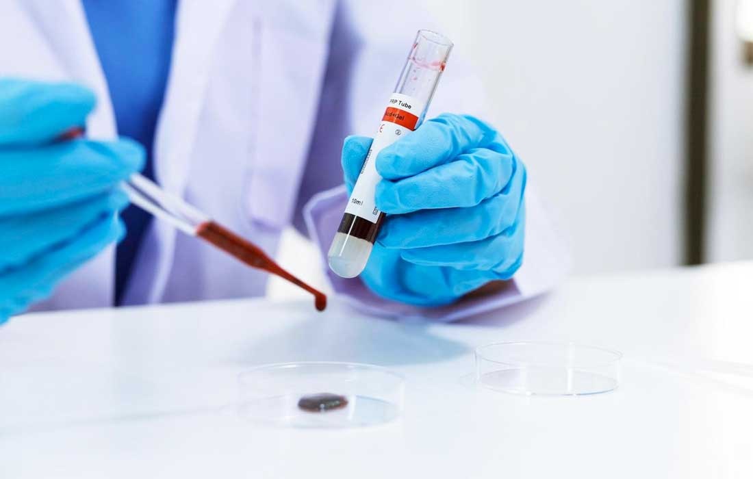 Rare Blood Group