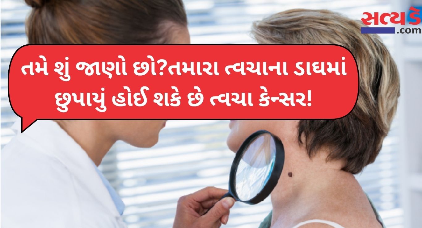 Skin Cancer Causes